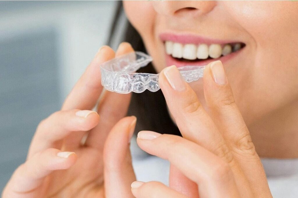 Ortodoncia invisible: invisalign