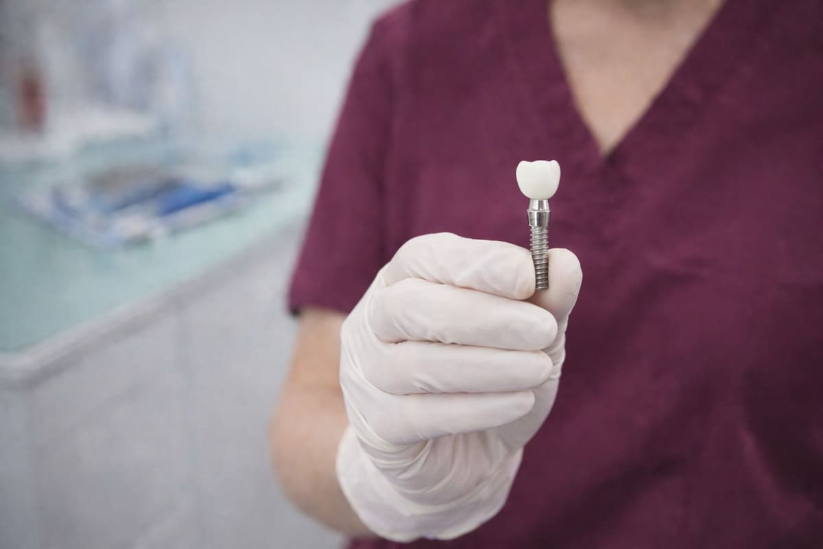 Implantologia en Valencia